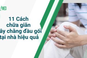 11 Cách chữa giãn dây chằng đầu gối tại nhà hiệu quả