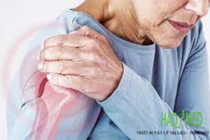 Đau vai gáy lan ra cánh tay là bệnh gì? Giải đáp từ Bác sĩ chuyên khoa