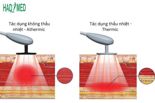 may song radio dieu tri dich dot pha trong y te hien dai