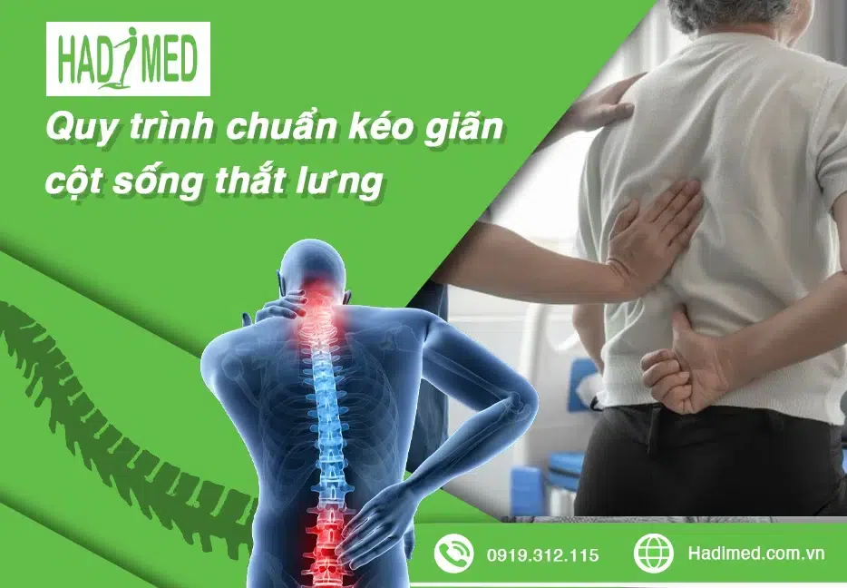 Quy trình chuẩn kéo giãn cột sống thắt lưng