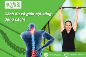 Cách đu xà giãn cột sống: lợi ích và hướng dẫn tập luyện hiệu quả