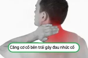 Căng cơ cổ bên trái: Nguyên nhân từ thói quen & Giải pháp giảm đau