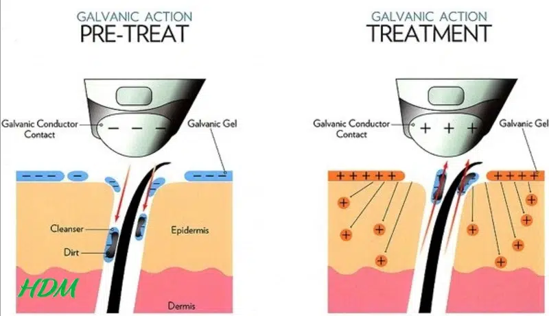 Dòng điện một chiều (Galvanic Currents)