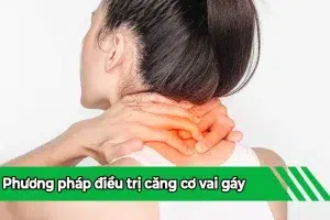 Căng cơ vai gáy: Nguyên nhân, triệu chứng và cách điều trị mới