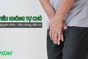 Nguyên nhân và giải pháp điều trị tiểu không kiểm soát hiệu quả