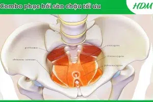 Combo phục hồi sàn chậu tối ưu: Giải pháp vàng cho phục hồi chức năng